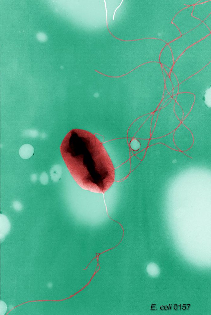 Imagen: Microbe World, BY-NC-SA 2.0 (vía Openverse). China: cadena perpetua por envenenar a niños en guardería